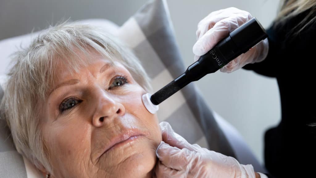 Microneedling Fort Collins CO Med Spa Treatments