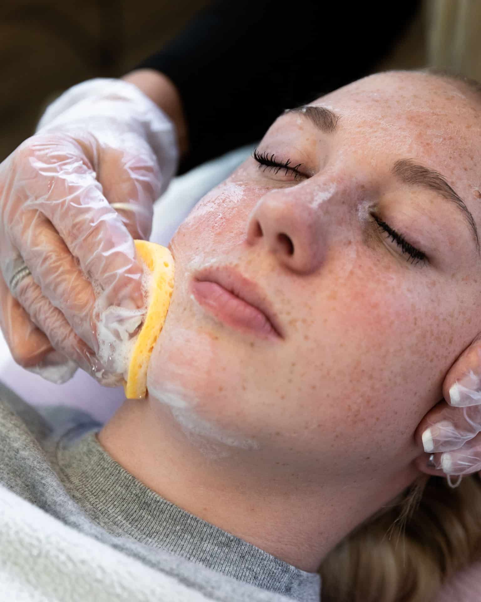 Premier Skin Clinic Acne Facial (2)