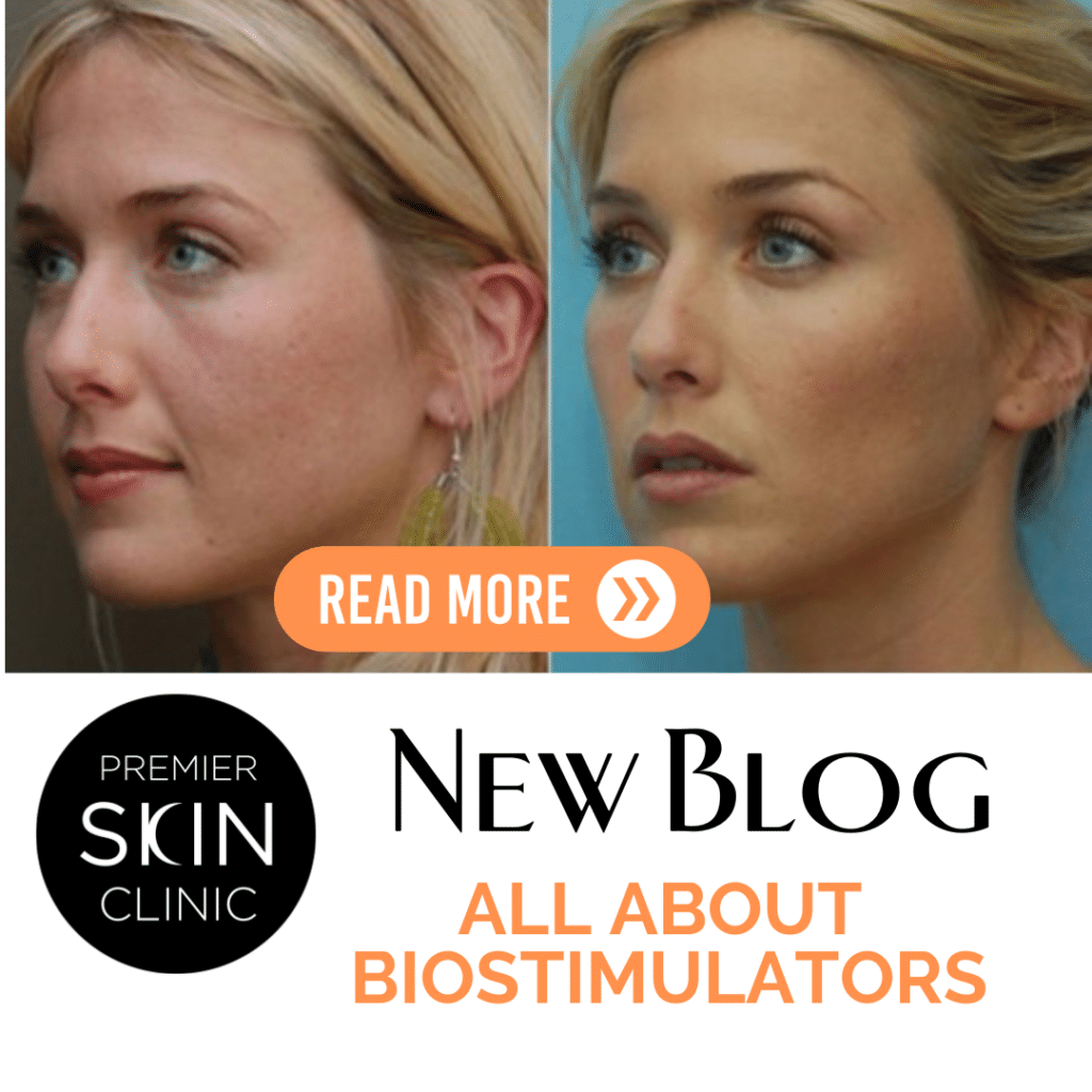 biostimulators