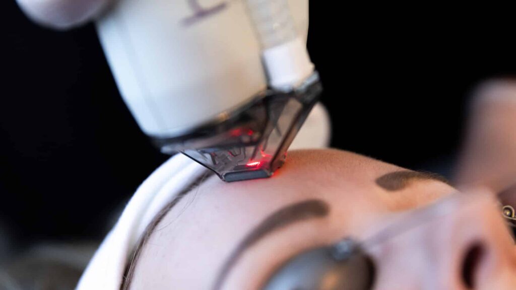 1739910063 Premier Skin Clinic HALO 1 1739910063 Premier Skin Clinic HALO 1