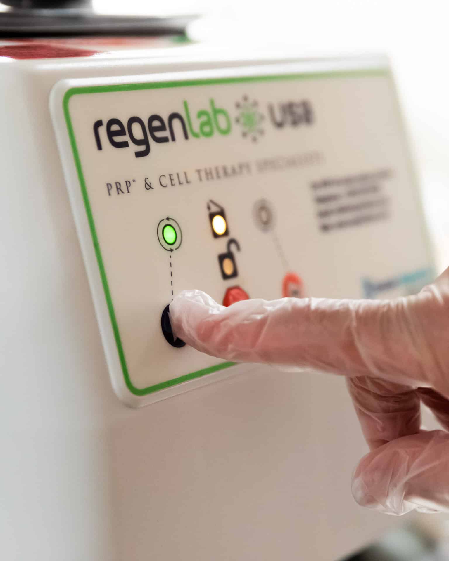 Premier Skin Clinic Hair Restoration with PRP 3