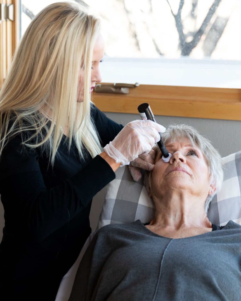 Premier Skin Clinic Microneedling 2