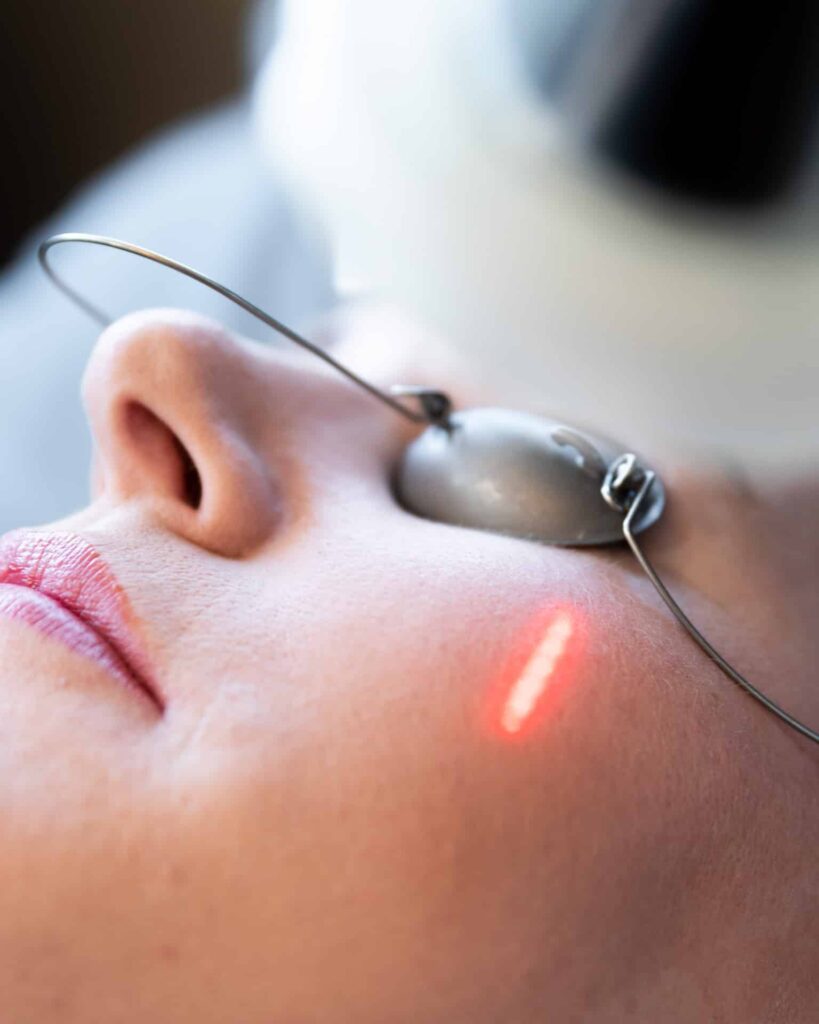 Premier Skin Clinic Nano Laser Peel 1 Premier Skin Clinic Nano Laser Peel 1