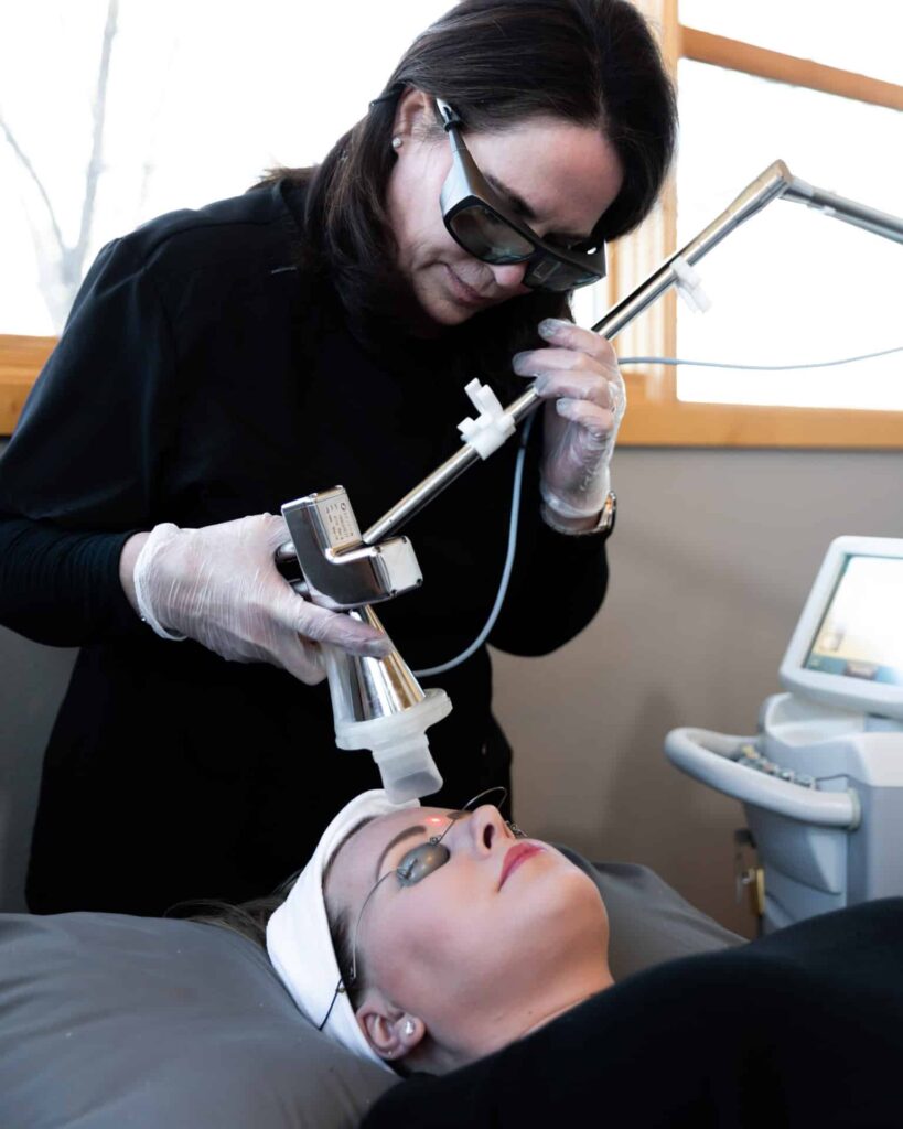 Premier Skin Clinic Nano Laser Peel 2 Premier Skin Clinic Nano Laser Peel 2