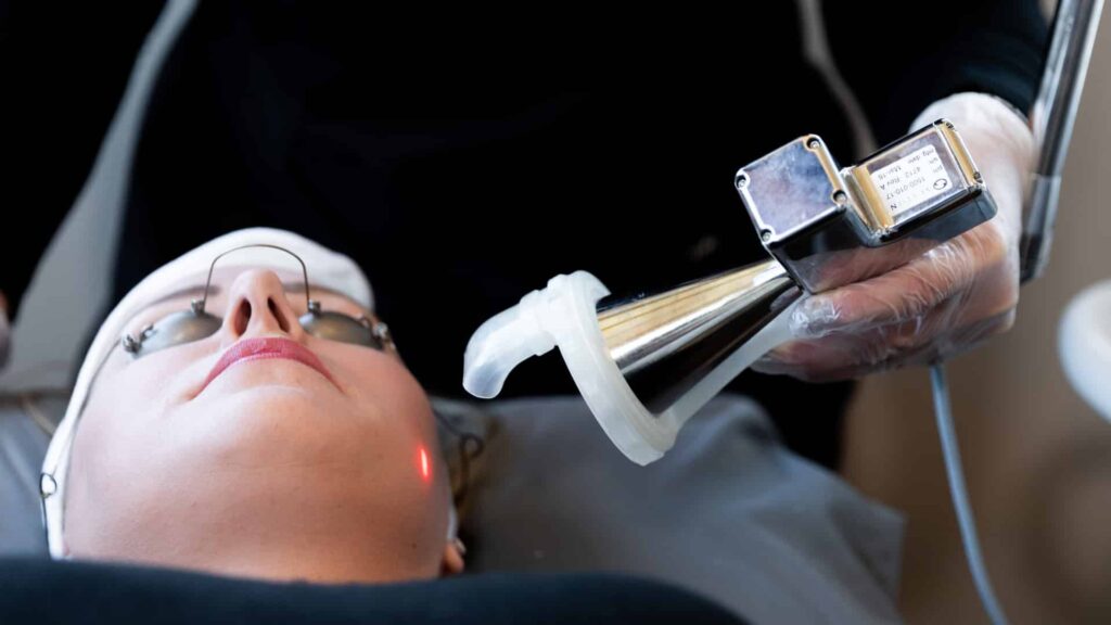 Premier Skin Clinic Nano Laser Peel 3 Premier Skin Clinic Nano Laser Peel 3