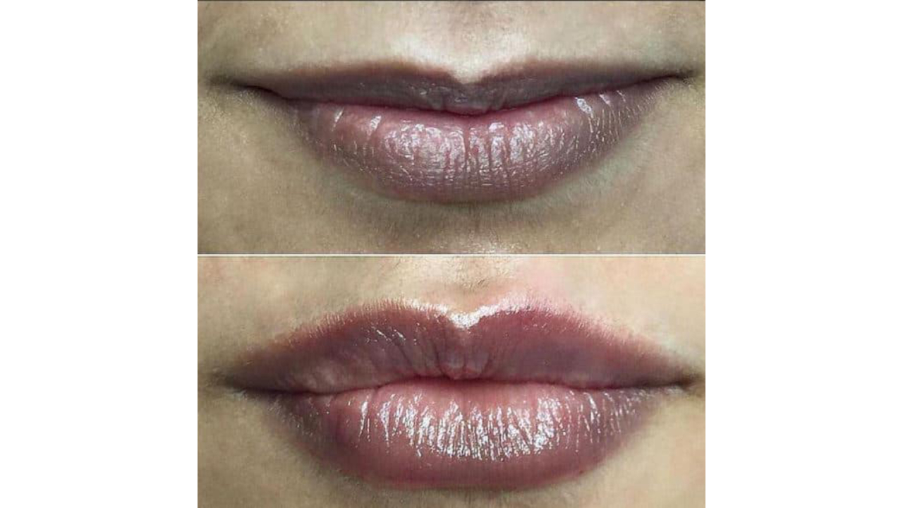 Revanesse-lips