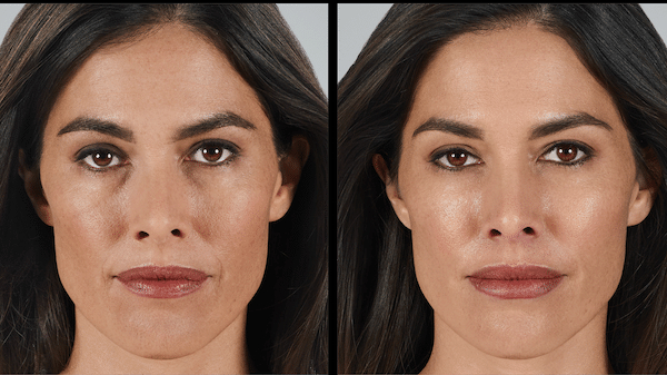 Before and After Image: Wrinkle Reducers - front