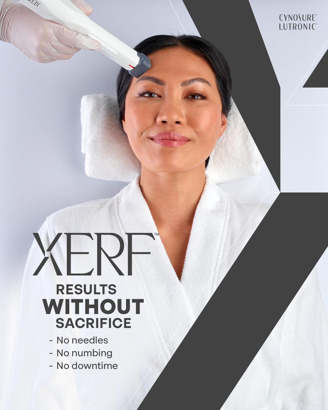 XERF