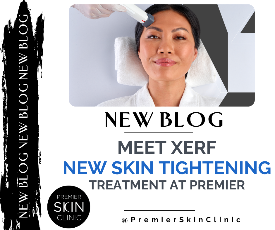 blog xerf