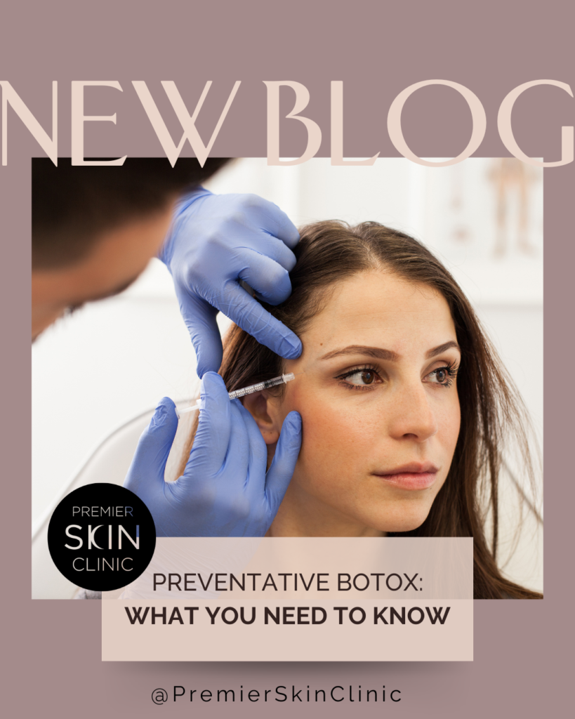 botox blog NEW BLOG: Preventative Botox - What You Need to Know At Premier Skin Clinic, we encounter many questions about preventative BOTOX®. Are my 20s too soon to start Botox? What about my 30s? If I have fine lines when I smile or raise my eyebrows, is now the time to start? Most people benefit from starting treatment earlier than they’d expect. While BOTOX® is well known for softening wrinkles that have already appeared, neuromodulators can also be used proactively to help prevent dynamic wrinkles from becoming deeper, more permanent lines. Premier Skin Clinic prides ourselves on our subtle, personalized approach that yields natural-looking results to help you continue to look like yourself as you age. VISIT OUR BLOG TO READ MORE https://premierskinclinic.com/preventative-botox-what-you-need-to-know/