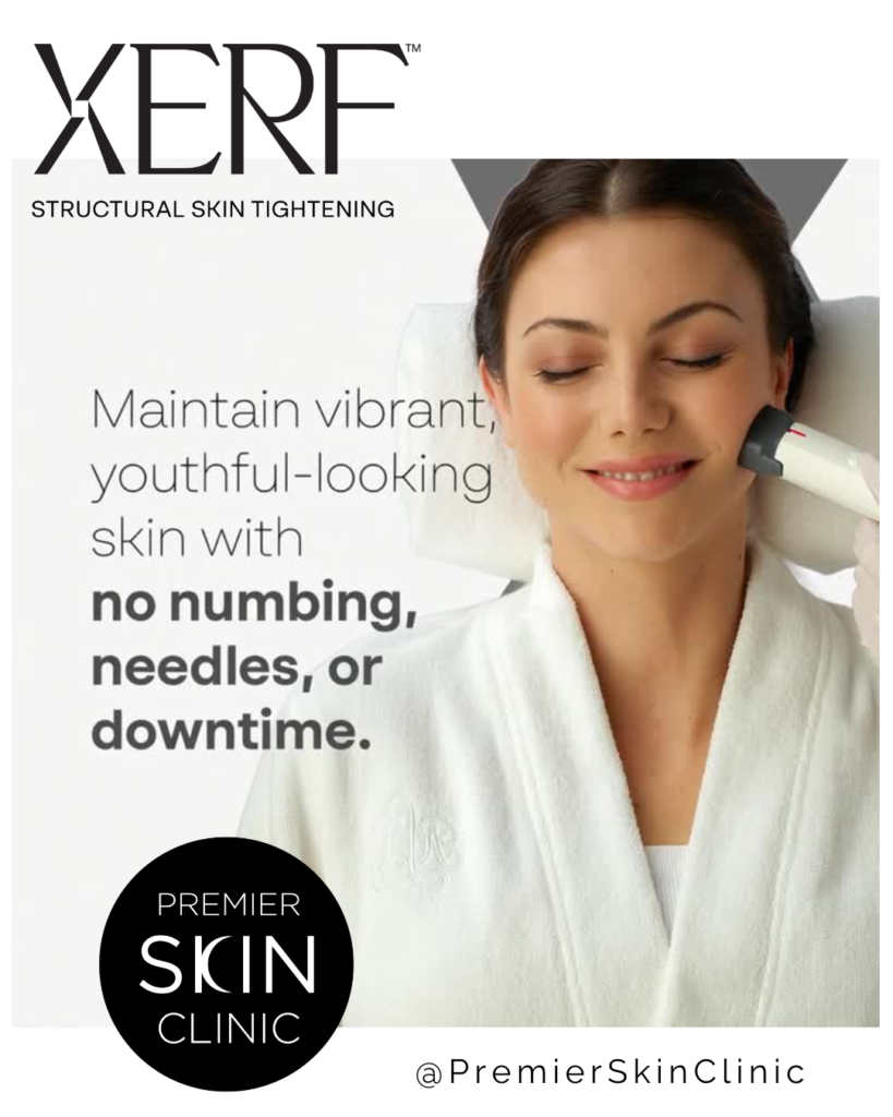 xerf4 Now Announcing XERF at Premier Skin Clinic! XERF is a next-generation radiofrequency (RF) technology designed to improve visible skin laxity and support collagen remodeling beneath the surface. Unlike traditional skin tightening treatments that target only one depth of tissue, XERF uses multifrequency monopolar radiofrequency energy to deliver treatment across multiple layers of the skin. This approach allows for a more customized experience that addresses both immediate skin tightening effects and continued improvement over time as collagen rebuilds.