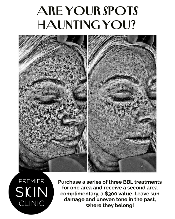 BBL3 OCTOBER PROMOS at Premier Skin Clinic